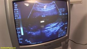 Redhead preggo fucked at the clinic