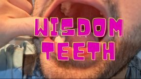 Wisdom teeth