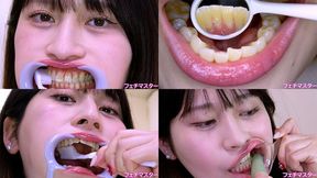Maina Yuuri - Observing Maina's teeth with a dental mirror & brushing her teeth while wearing a mouth opener & finger toothbrushing while wearing a lip hook - MOV