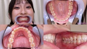 Mino ri Mashiro - Watching Inside mouth of Japanese cute girl - MOV