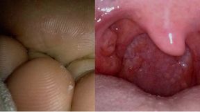 An Exploration Too Far