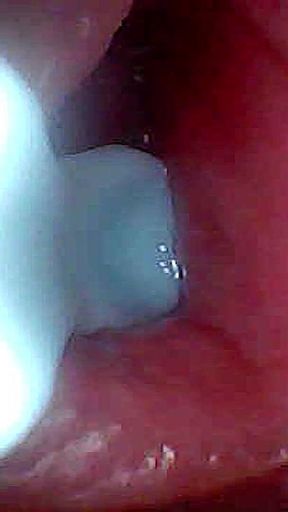 I Couldn’t Believe What Happens Inside the Penis as Sperm Passes Through (endoscopic Footage)