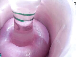 Lesbos cervix play penetration, fingering and void urine directly into the bladder of the other woman by peehole