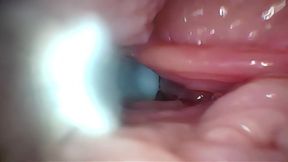 Semen in Cervix Wide Stretching Pussy Endoscope!