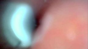 Endoscope camera captures moment of male ejaculation