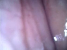 Deep look inside cum filled ass with endoscope