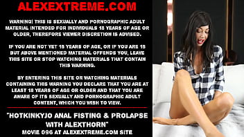 Hotkinkyjo anal fisting &amp_ prolapse with AlexThorn