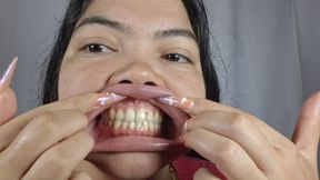 Pervert shows her dirty yellow teeth: tooth fetish