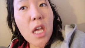 A look inside my mouth in my 20s (2013)