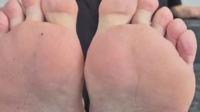 Sweaty feet