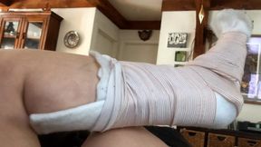 How I Broke My Ankle 2019: Sophia Sylvan Leg Cast
