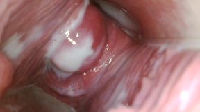 Endoscope in my pussy
