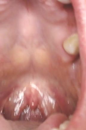 Throat and Mouth Spit Strings Uvula Tonsils Uvula
