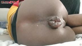 fanclub Skinny Black Boy Flattens up His Anus Until It&#039;s Ready to Fuck - Dj Buttpussy