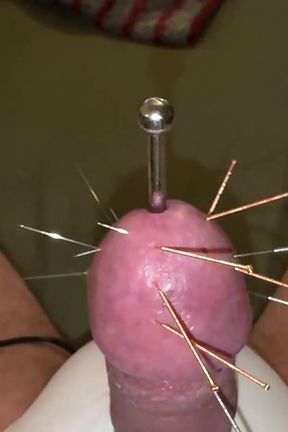 Acupuncture - Orgasm!
