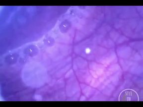 Pumping Air Into My Full Bladder with the Minicam Inside