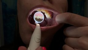 Checking My Teeth with the Dental Mirror