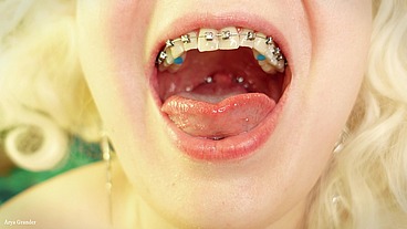 brace face review video close up (Arya Grander)
