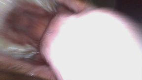 Lexi Endoscopic Mouth Tour