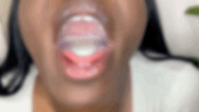 Milky Mouth, Lips, and Throat