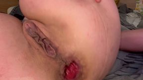 anal stretching,prolapsing and speculum