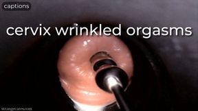 cervix wrinkled orgasms - captioned