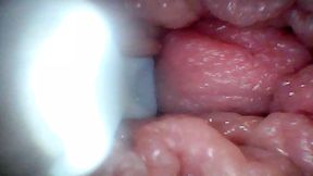 Endoscope camera shows the most sensitive parts of the penis Educational video