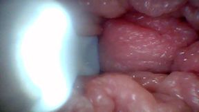 Endoscope camera shows the most sensitive parts of the penis Educational video