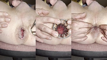Reneenicolecd - update #51 - Anal cage gape hole POV - Jun 18, 2026