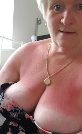 Red tits from sitting in the sun too long yesterday!