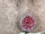 I'm perverted boy, need fisting and stuffing my asshole everyday! Can't stop cumming