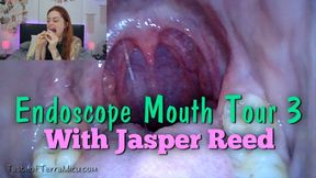 Endoscope Mouth Tour 3 - Jasper Reed 720 HD WMV