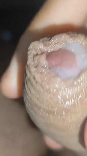 I Have the Largest Ejaculating Phimosis in the World!!