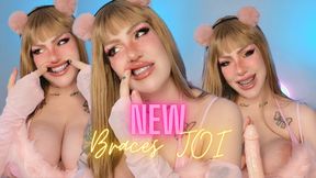 NEW braces JOI
