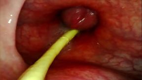 Big Cock Pounds Anal Slut's Gaping Ass Creampie