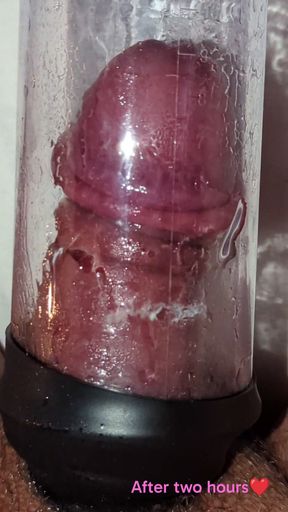 Extreme Vacuum Penis pumping