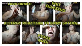 MADNESS ALLERGY REACTION TO BODY LOTION