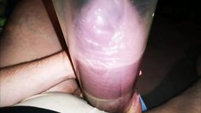 It&#039;s Starting with a Finger...