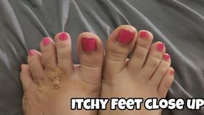 Close-Up Itchy Feet & Toes – Irritated Skin from Scratching Detail