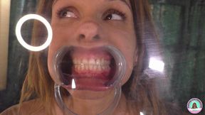 PGP Marissa Lee Dental Spreader