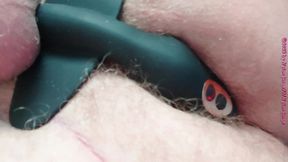 prostata vibration plug ** nahaufnahme **