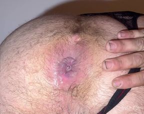 Creampie hairy anal