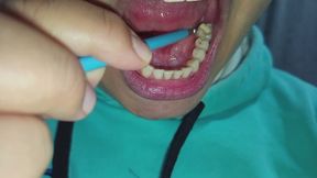 Dientes feos, apretón de lengua y primer plano de venas de la lengua
