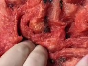 Fisting a Watermelon