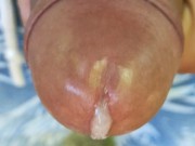 Close up cumming out of glans