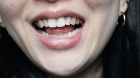 Aurora's Teeth Are Simply Irresistable