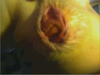 This is what happens if you fist and dildo your asshole too much