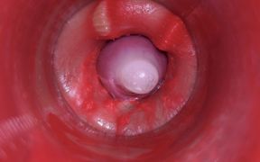 Camera Inside Pussy: Powerfull Cum in Pussy! Best Internal Asmr in 4K More Sperm