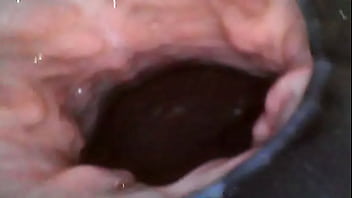 I recorded with an endoscope tool a creampie inside my pussy and dripping it out