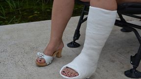 Wife in cast